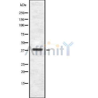 Western blot analysis ITBP2 using Jurkat whole cell lysates