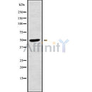 Western blot analysis of extracts from various samples, using K1H2 Antibody.
 Lane 1: 293 treated with blocking peptide.
 Lane 2: 293;
 Lane 3: Rat lung,Hela;
 