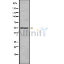 Western blot analysis of K1H5 using LOVO whole cell lysates
