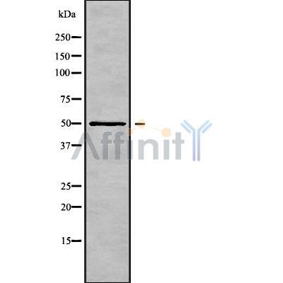 Western blot analysis of K1H5 using LOVO whole cell lysates