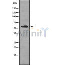 Western blot analysis of K2C6B using MCF7 whole cell lysates