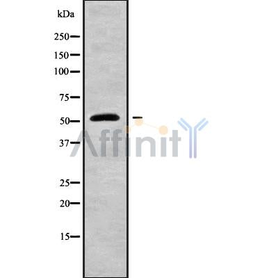 Western blot analysis of KRT81 using COLO205 whole cell lysates