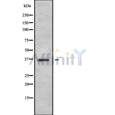 Western blot analysis of MAGA4 using Jurkat whole cell lysates