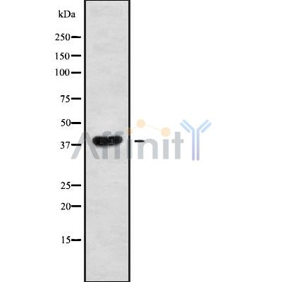 Western blot analysis of MAGAA using RAW264.7 whole cell lysates
