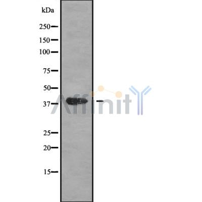Western blot analysis of MAGB1 using HepG2 whole cell lysates