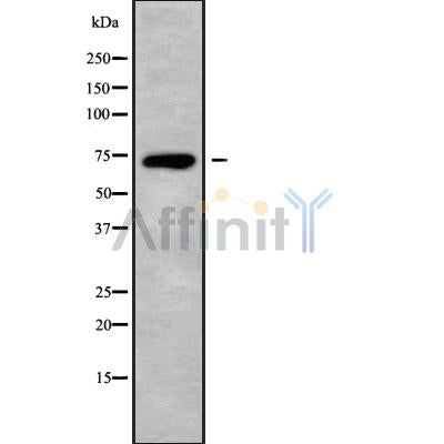 Western blot analysis of extracts from Mouse lung, using MAGC3 Antibody. The lane on the left was treated with blocking peptide.
