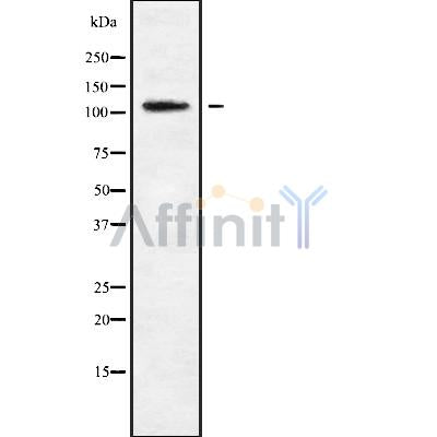 DF9019 at 1/100 staining Mouse spleen tissue by IHC-P. The sample was formaldehyde fixed and a heat mediated antigen retrieval step in citrate buffer was performed. The sample was then blocked and incubated with the antibody for 1.5 hours at 22¡ãC. An HRP conjugated goat anti-rabbit antibody was used as the secondary