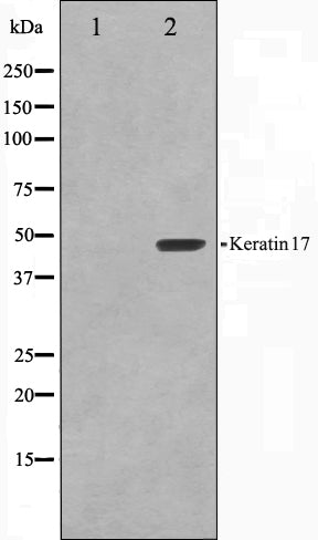 Western blot analysis on HuvEc cell lysate using Keratin 17 Antibody. The lane on the left is treated with the antigen-specific peptide.
