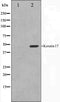 Western blot analysis on HuvEc cell lysate using Keratin 17 Antibody. The lane on the left is treated with the antigen-specific peptide.