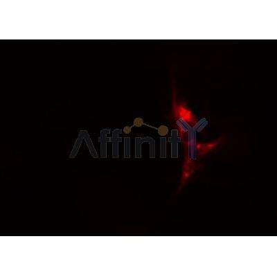 AF0190 staining A-431 cells by IF/ICC. The sample were fixed with PFA and permeabilized in 0.1% Triton X-100,then blocked in 10% serum for 45 minutes at 25¡ãC. The primary antibody was diluted at 1/200 and incubated with the sample for 1 hour at 37¡ãC. An  Alexa Fluor 594 conjugated goat anti-rabbit IgG (H+L) antibody(Cat.