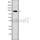 Western blot analysis of PDCD6IP using K562 whole cell lysates