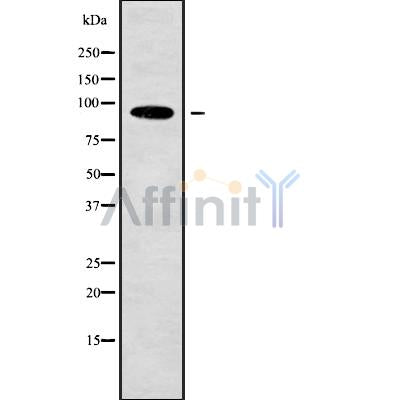 Western blot analysis of PDCD6IP using K562 whole cell lysates