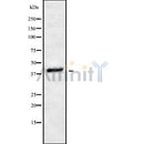 Western blot analysis of extracts from various samples, using PDCD2L Antibody.
 Lane 1: Mouse lung treated with blocking peptide;
 Lane 2: Mouse lung;
 Lane 3: Rat heart.