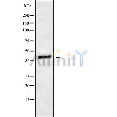 Western blot analysis of extracts from various samples, using PDCD2L Antibody.
 Lane 1: Mouse lung treated with blocking peptide;
 Lane 2: Mouse lung;
 Lane 3: Rat heart.