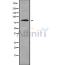 Western blot analysis of PLCD1 using K562 whole cell lysates