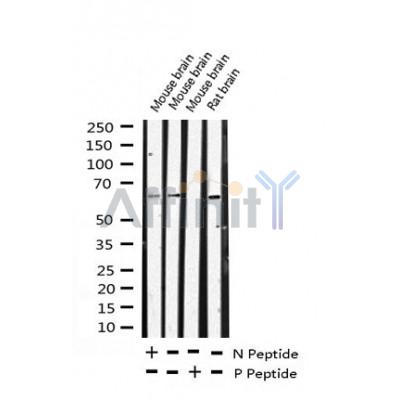 AF3212 staining HeLa by IF/ICC. The sample were fixed with PFA and permeabilized in 0.1% Triton X-100,then blocked in 10% serum for 45 minutes at 25¡ãC. The primary antibody was diluted at 1/200 and incubated with the sample for 1 hour at 37¡ãC. An  Alexa Fluor 594 conjugated goat anti-rabbit IgG (H+L) Ab, diluted at 1/600, was used as the secondary antibod
