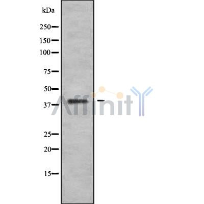 Western blot analysis of WN10B using Jurkat whole cell lysates