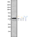Western blot analysis of WNT4 using Jurkat whole cell lysates