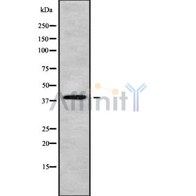 Western blot analysis of WNT4 using Jurkat whole cell lysates