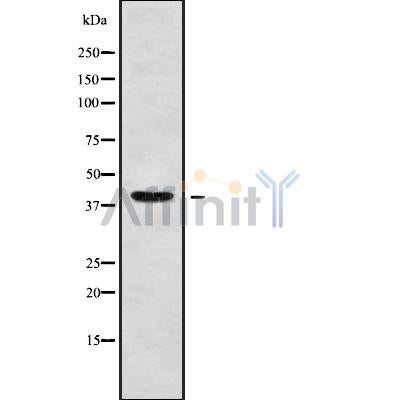 DF9041 at 1/100 staining Human Melanoma tissue by IHC-P. The sample was formaldehyde fixed and a heat mediated antigen retrieval step in citrate buffer was performed. The sample was then blocked and incubated with the antibody for 1.5 hours at 22¡ãC. An HRP conjugated goat anti-rabbit antibody was used as the secondary