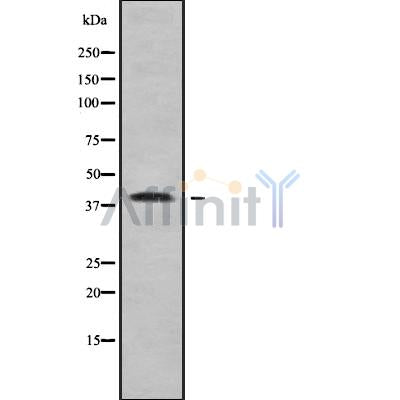 DF9042 at 1/100 staining Human kidney tissue by IHC-P. The sample was formaldehyde fixed and a heat mediated antigen retrieval step in citrate buffer was performed. The sample was then blocked and incubated with the antibody for 1.5 hours at 22¡ãC. An HRP conjugated goat anti-rabbit antibody was used as the secondary