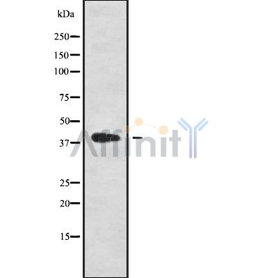 DF9043 at 1/100 staining Mouse kidney tissue by IHC-P. The sample was formaldehyde fixed and a heat mediated antigen retrieval step in citrate buffer was performed. The sample was then blocked and incubated with the antibody for 1.5 hours at 22¡ãC. An HRP conjugated goat anti-rabbit antibody was used as the secondary