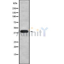 DF9046 at 1/100 staining Human liver cancer tissue by IHC-P. The sample was formaldehyde fixed and a heat mediated antigen retrieval step in citrate buffer was performed. The sample was then blocked and incubated with the antibody for 1.5 hours at 22¡ãC. An HRP conjugated goat anti-rabbit antibody was used as the secondary