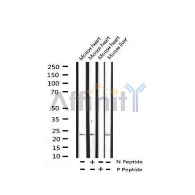 AF3277 staining Hela by IF/ICC. The sample were fixed with PFA and permeabilized in 0.1% Triton X-100,then blocked in 10% serum for 45 minutes at 25¡ãC. The primary antibody was diluted at 1/200 and incubated with the sample for 1 hour at 37¡ãC. An  Alexa Fluor 594 conjugated goat anti-rabbit IgG (H+L) Ab, diluted at 1/600, was used as the secondary antibod