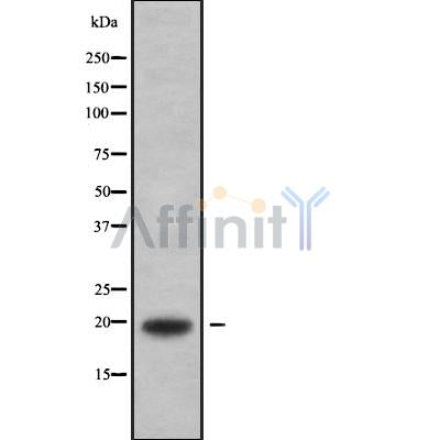 Western blot analysis of MYLPF using HepG2 whole cell lysates