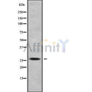 Western blot analysis GZMA using COLO205 whole cell lysates