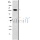 Western blot analysis of RAD54B using COLO205 whole cell lysates