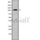 Western blot analysis of CENPC1 using Jurkat whole cell lysates