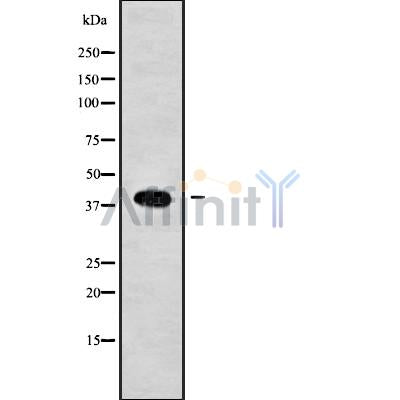 DF9062 at 1/100 staining Rat kidney tissue by IHC-P. The sample was formaldehyde fixed and a heat mediated antigen retrieval step in citrate buffer was performed. The sample was then blocked and incubated with the antibody for 1.5 hours at 22¡ãC. An HRP conjugated goat anti-rabbit antibody was used as the secondary
