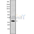 DF9063 at 1/100 staining Rat brain tissue by IHC-P. The sample was formaldehyde fixed and a heat mediated antigen retrieval step in citrate buffer was performed. The sample was then blocked and incubated with the antibody for 1.5 hours at 22¡ãC. An HRP conjugated goat anti-rabbit antibody was used as the secondary