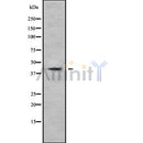Western blot analysis NFKBIL1 using HepG2 whole cell lysates