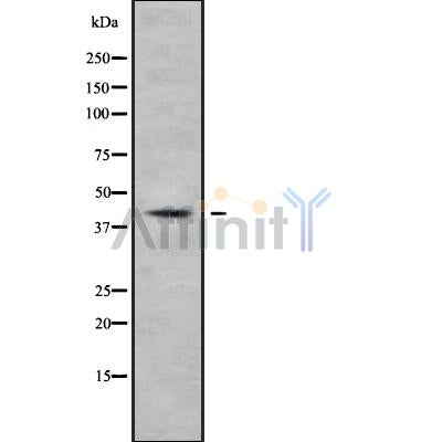 Western blot analysis NFKBIL1 using HepG2 whole cell lysates