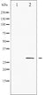 AF3325 staining A2780 by IF/ICC. The sample were fixed with PFA and permeabilized in 0.1% Triton X-100,then blocked in 10% serum for 45 minutes at 25¡ãC. The primary antibody was diluted at 1/200 and incubated with the sample for 1 hour at 37¡ãC. An  Alexa Fluor 594 conjugated goat anti-rabbit IgG (H+L) Ab, diluted at 1/600, was used as the secondary antibod