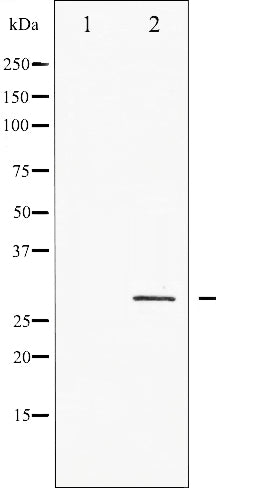 AF3325 staining A2780 by IF/ICC. The sample were fixed with PFA and permeabilized in 0.1% Triton X-100,then blocked in 10% serum for 45 minutes at 25¡ãC. The primary antibody was diluted at 1/200 and incubated with the sample for 1 hour at 37¡ãC. An  Alexa Fluor 594 conjugated goat anti-rabbit IgG (H+L) Ab, diluted at 1/600, was used as the secondary antibod