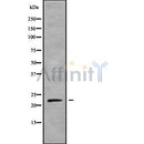 DF9067 at 1/100 staining Mouse lung tissue by IHC-P. The sample was formaldehyde fixed and a heat mediated antigen retrieval step in citrate buffer was performed. The sample was then blocked and incubated with the antibody for 1.5 hours at 22¡ãC. An HRP conjugated goat anti-rabbit antibody was used as the secondary