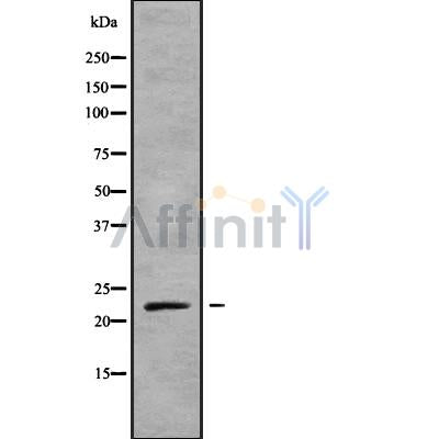 DF9067 at 1/100 staining Mouse lung tissue by IHC-P. The sample was formaldehyde fixed and a heat mediated antigen retrieval step in citrate buffer was performed. The sample was then blocked and incubated with the antibody for 1.5 hours at 22¡ãC. An HRP conjugated goat anti-rabbit antibody was used as the secondary