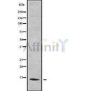 DF9068 at 1/100 staining Human liver tissue by IHC-P. The sample was formaldehyde fixed and a heat mediated antigen retrieval step in citrate buffer was performed. The sample was then blocked and incubated with the antibody for 1.5 hours at 22¡ãC. An HRP conjugated goat anti-rabbit antibody was used as the secondary