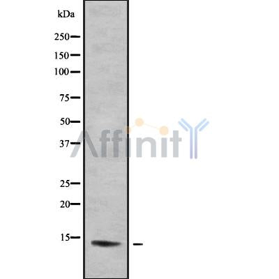 DF9068 at 1/100 staining Human liver tissue by IHC-P. The sample was formaldehyde fixed and a heat mediated antigen retrieval step in citrate buffer was performed. The sample was then blocked and incubated with the antibody for 1.5 hours at 22¡ãC. An HRP conjugated goat anti-rabbit antibody was used as the secondary