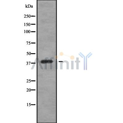 Western blot analysis of CREB3L4 using K562 whole cell lysates