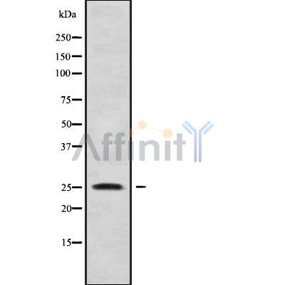 Western blot analysis of KLF16 using RAW264.7 whole cell lysates