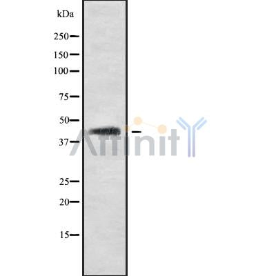 Western blot analysis SP5 using LOVO whole cell lysates