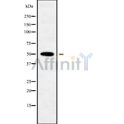 DF9088 at 1/100 staining Rat lung tissue by IHC-P. The sample was formaldehyde fixed and a heat mediated antigen retrieval step in citrate buffer was performed. The sample was then blocked and incubated with the antibody for 1.5 hours at 22¡ãC. An HRP conjugated goat anti-rabbit antibody was used as the secondary