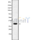 Western blot analysis of extracts from mouse brain, using MRPS15 Antibody. Lane 1 was treated with the blocking peptide.