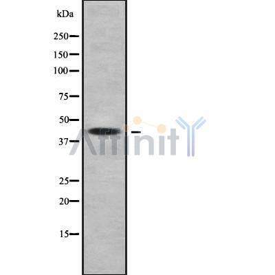 Western blot analysis of HSD3B1 using Jurkat whole cell lysates