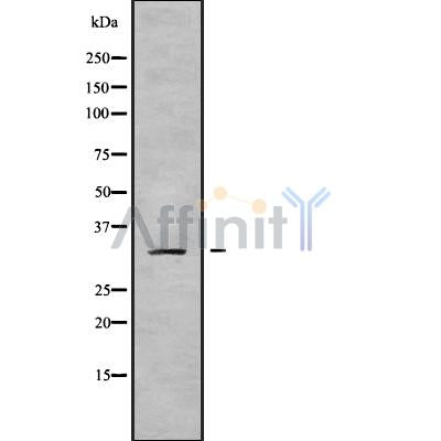 Western blot analysis of extracts from Hela, using MRPL19 Antibody. Lane 1 was treated with the blocking peptide.