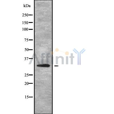 Western blot analysis of extracts from Mouse lung, using MRPL2 Antibody. The lane on the left was treated with blocking peptide.